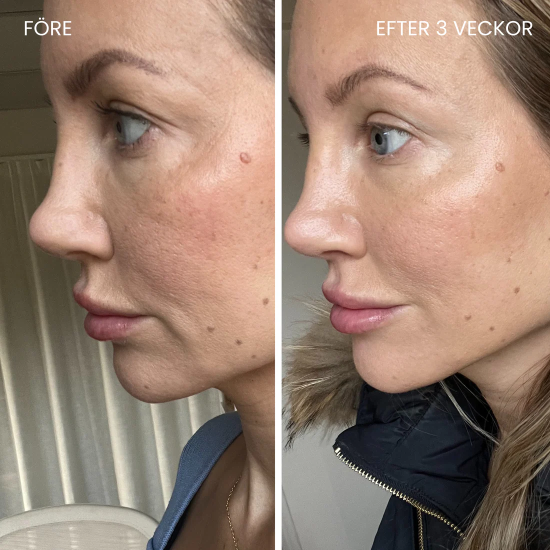 LUNA&SKIN - Professionell LED-Terapi