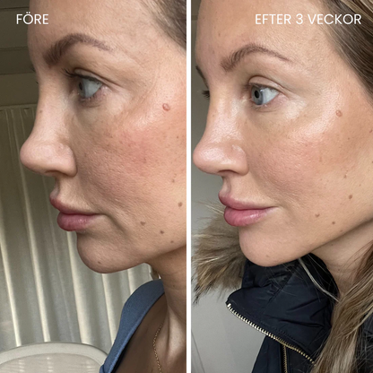 LUNA&SKIN - Professionell LED-Terapi