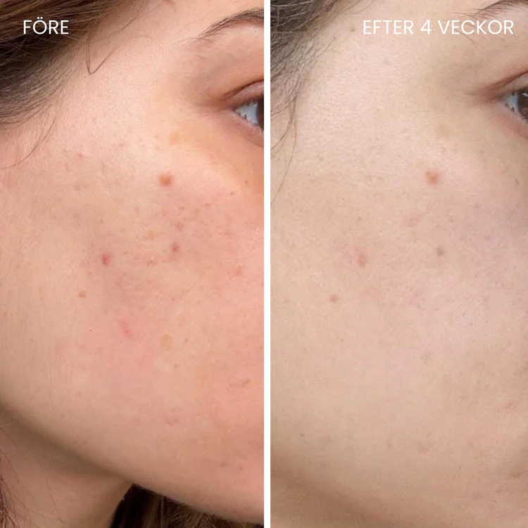 LUNA&SKIN - Professionell LED-Terapi