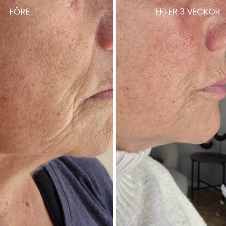 LUNA&SKIN - Professionell LED-Terapi